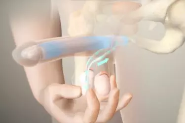 best doctor for ed treatment in manesar, cost of penile implant surgery in manesar gurgaon india, best urologist in manesar